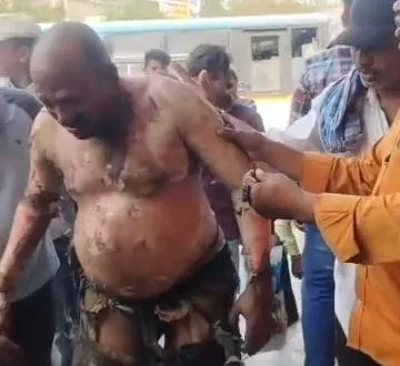 गंभीर हालत में अस्पताल में भर्ती